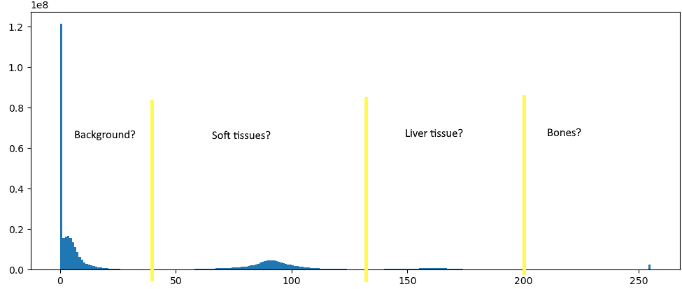 Histogram of the micro-CT values.