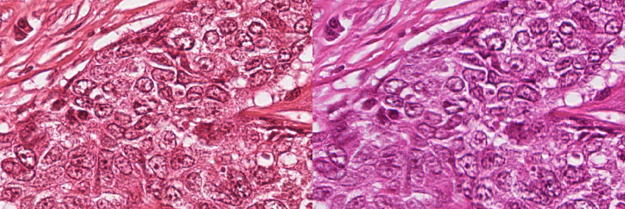 Figure 2.6. Same region cropped from an image in the ICPR 2012 MITOS dataset, acquired with two slide scanners: (left) an Aperio ScanScope XT and (right) a Hamamatsu NanoZoomer 2.0-HT, showing the difference in colour and image quality in the digital image.