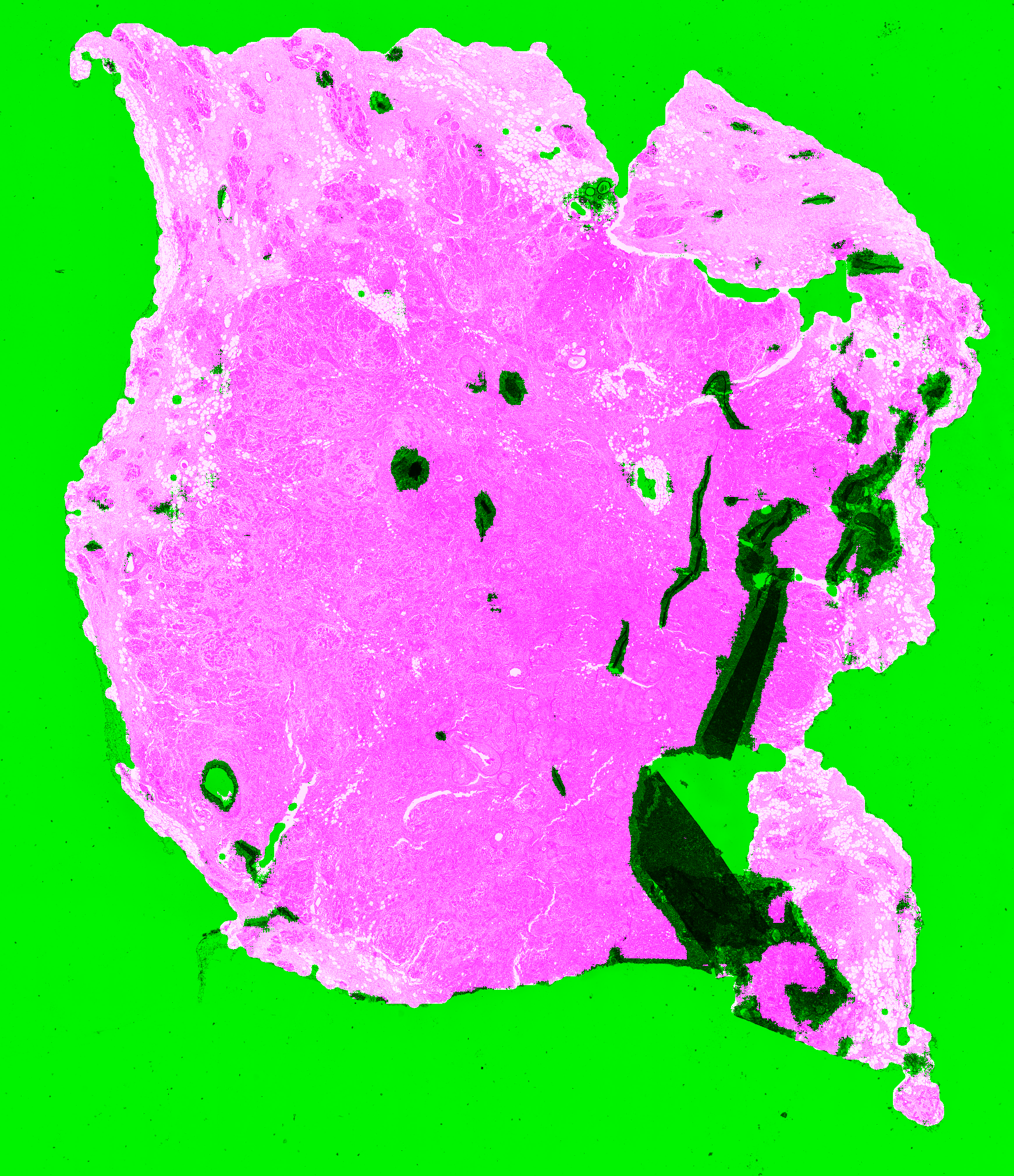 Figure 6.14. Prediction of artefactual regions of the PAN-GA50 network on the TCGA D8-A141 slide. Detected artefacts and background are shown in green, normal tissue is shown in pink.