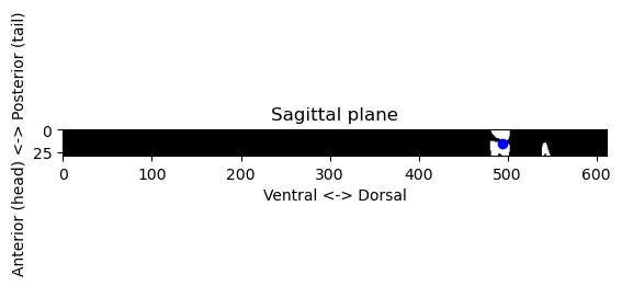 Slice in the sagittal plane around the reference point.