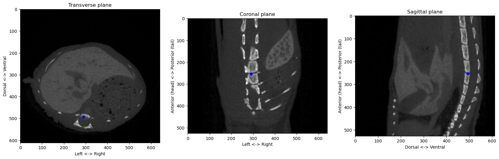 CT volume in the three anatomical planes with the automatically found reference point