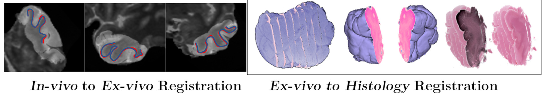 “In-vivo” MR to “ex-vivo” MR to histology images registration, from (Goubran et al. 2015)