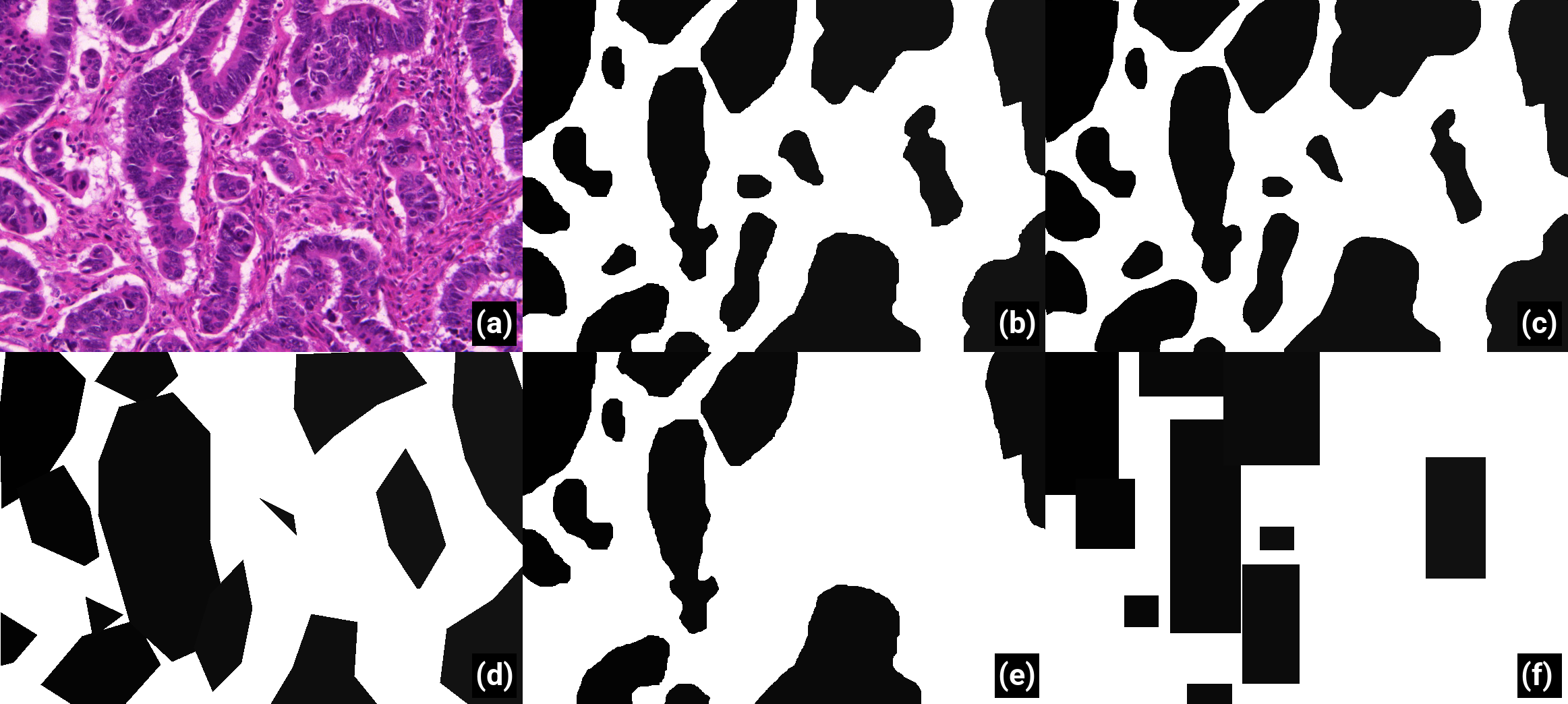 Examples of corrupted annotations generated on the GlaS dataset to simulate different levels of supervision and annotation effort. (a) Original image, (b) Original annotations, (c) Low contour deformations, (d) High contour deformations, (e) 50% Noise (i.e., 50% of the objects of interest are labelled as background), (f) 50% noise + Bounding Boxes.