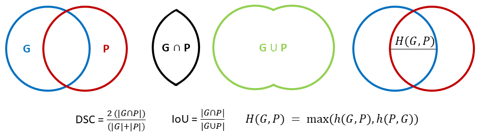 Illustration of how the 3 basic metrics are computed. G is the ground truth mask and P the predicted mask.