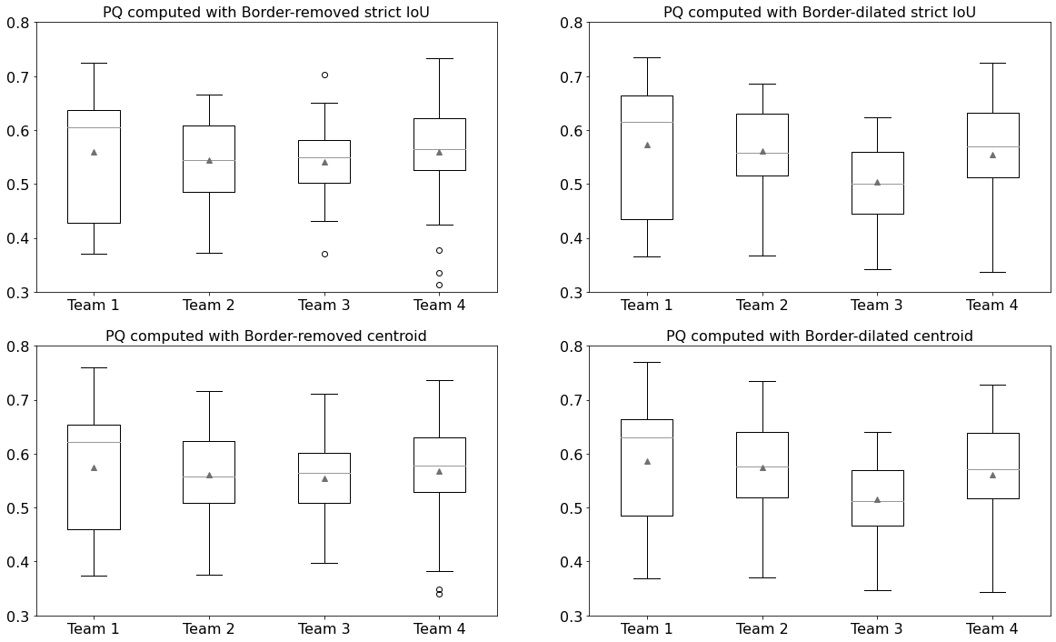 Boxplots of the PQ distributions on the 25 test patients computed for the four teams in the four conditions analyzed. Horizontal lines show the median value, triangles show the mean value. The boxes delimitate the quartile range (P25%-P75%) and the external bars the non-outlier minimum and maximum values.