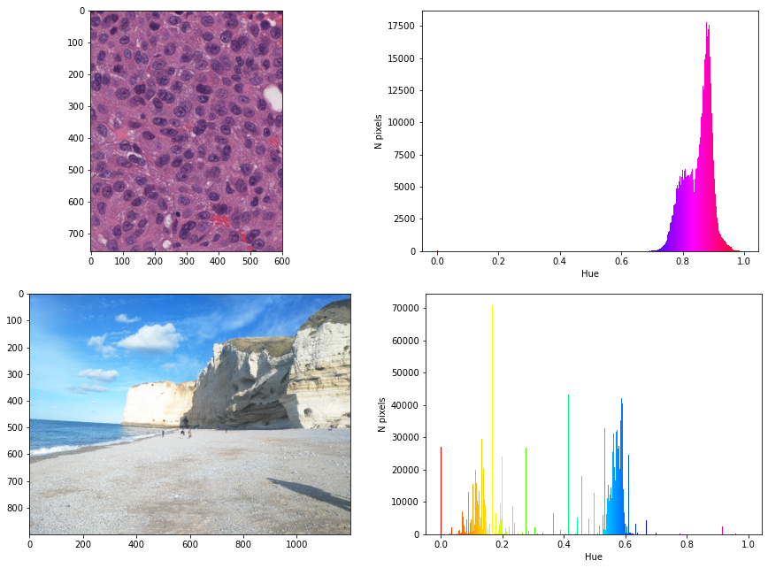 Figure 2.10. Difference in hue histograms between an H&E-stained histopathological image (taken from the MoNuSAC dataset [46]) and a natural photographic image. Even though there are dominant hues in the photographic image, the concentration of the values into narrow peaks is much more visible in the histopathological image.