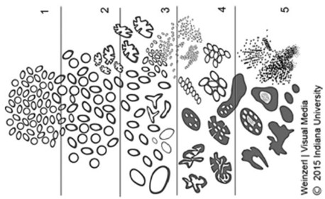 Figure 2.4. ISUP Gleason schematic diagrams for Gleason histological patterns (reproduced from [8]).