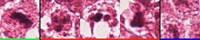 Figure 3.1. Example of certain mitosis (green), certain non-mitosis (red) and probably mitosis (blue) nuclei from an image patch of the MITOS-ATYPIA-14 dataset.