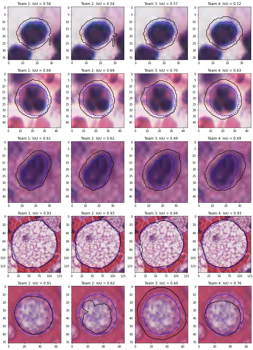 Figure 4.23. Predictions of four competing teams on some nuclei from the MoNuSAC 2020 challenge. From top to bottom: lymphocyte (~200px), neutrophil (~500px), epithelial (~300px), and two macrophages (~9600px and ~1800px). Ground truth annotations are shown with dashed blue lines, predicted segmentation with black lines.
