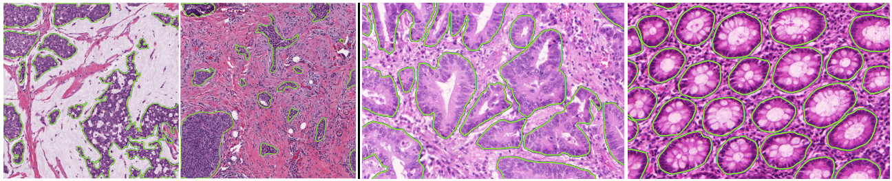 Figure 5.3. Annotated images from the Epithelium (left) and GlaS (right) datasets.