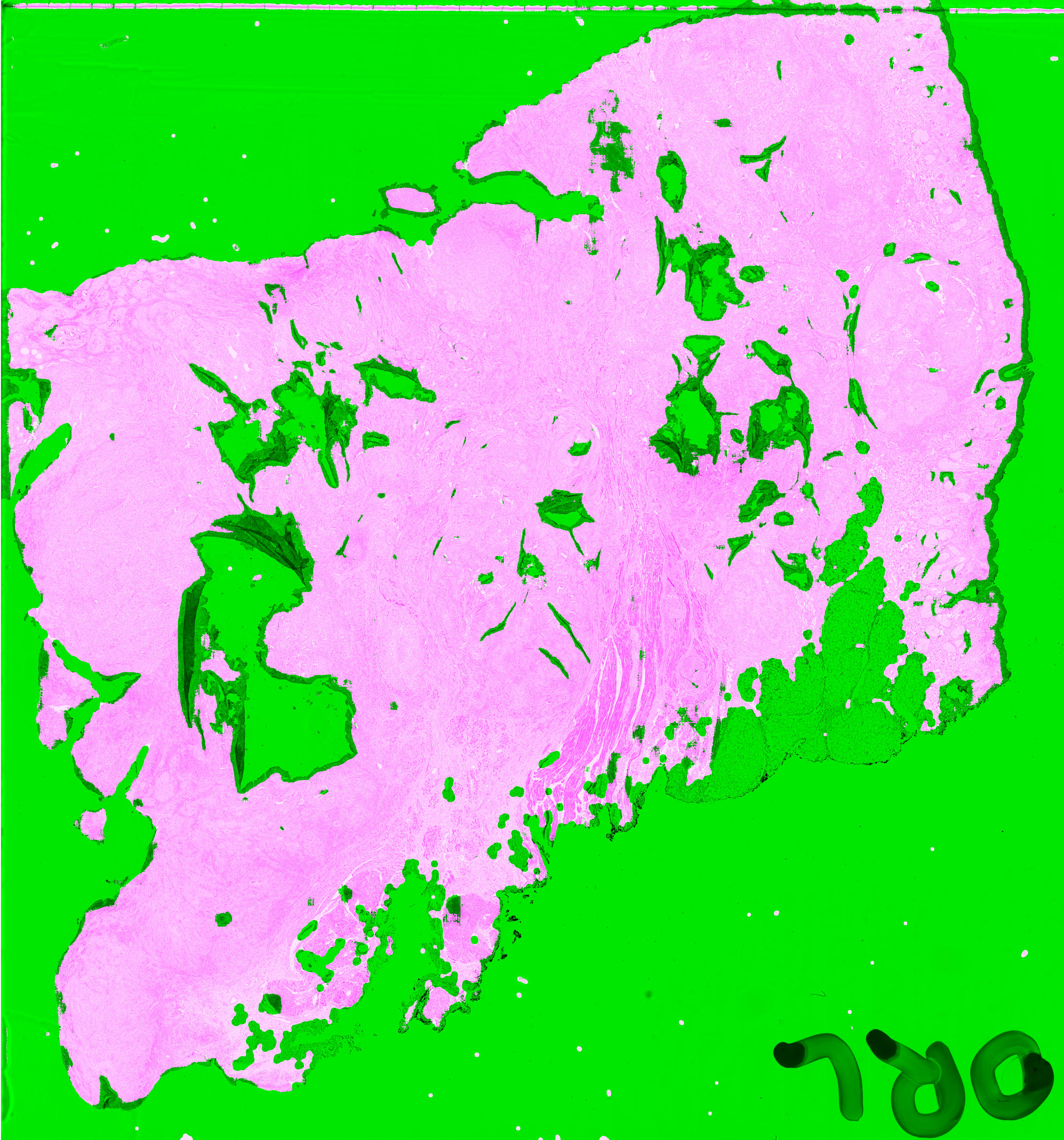 Figure 6.10. Prediction of artefactual regions of the PAN-GA50 network on the Block C slide. Detected artefacts and background are shown in green, normal tissue is shown in pink.