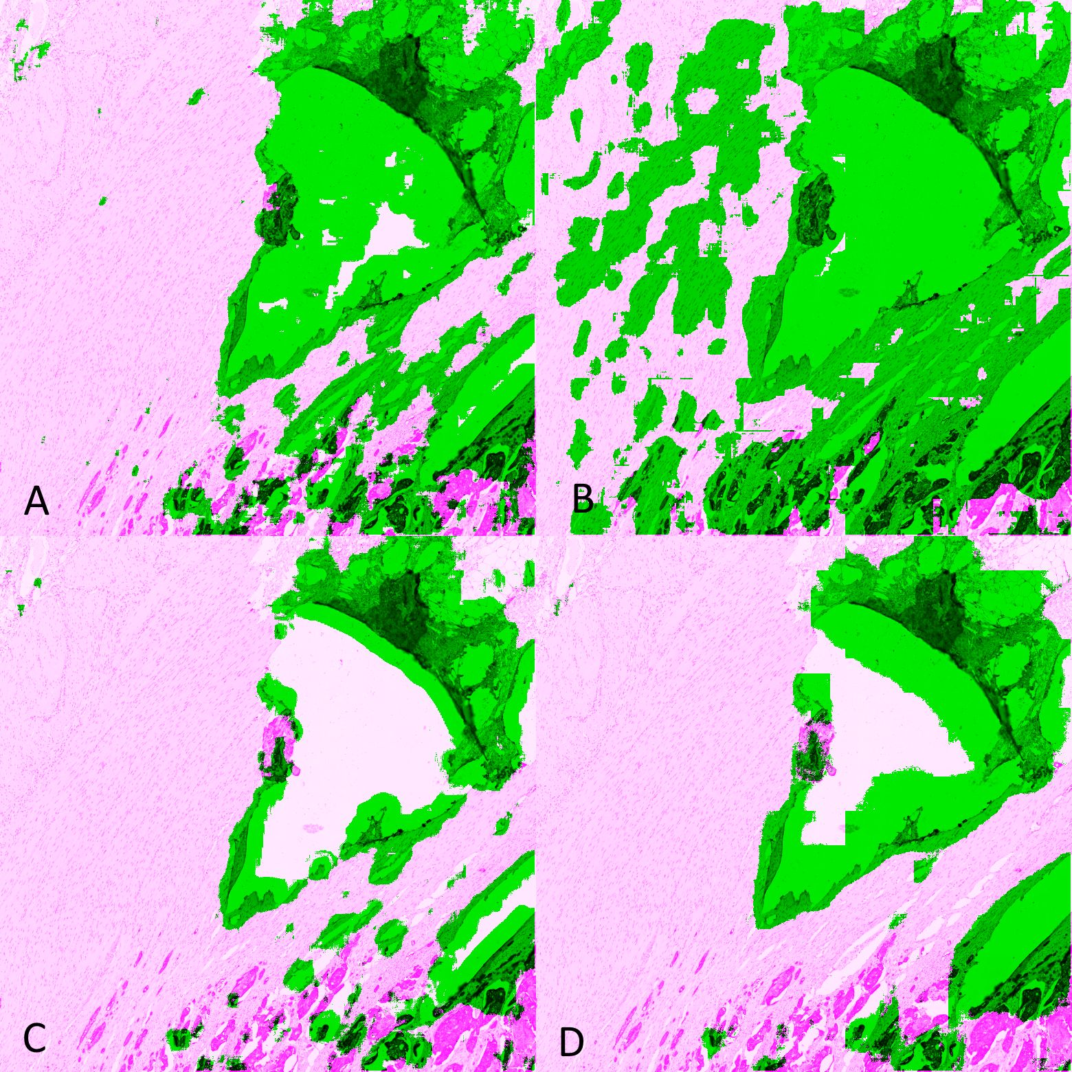 Figure 6.8. Predictions on a validation tile for (A) ShortRes / Only Positive, (B) U-Net / Only Positive, (C) ShortRes / GA50, (D) U-Net / GA50. Detected artefacts are shown in green, normal tissue is shown in pink.