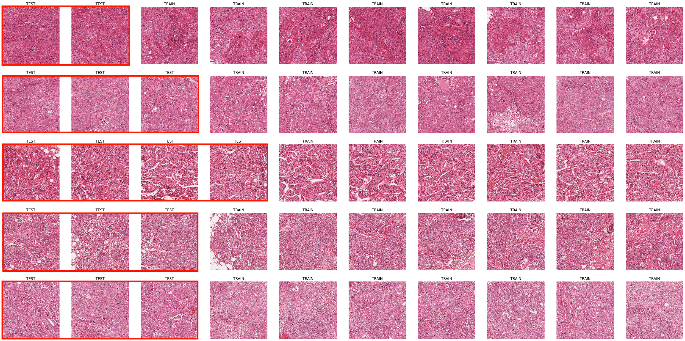 Figure 8.1. All (heavily down-sampled) images from the MITOS12 dataset. Each row corresponds to a different WSI. Images within the red rectangles are part of the test set.