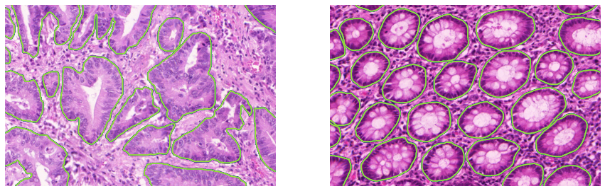Figure A.2. Example of images and annotated glands from the GlaS challenge training set.